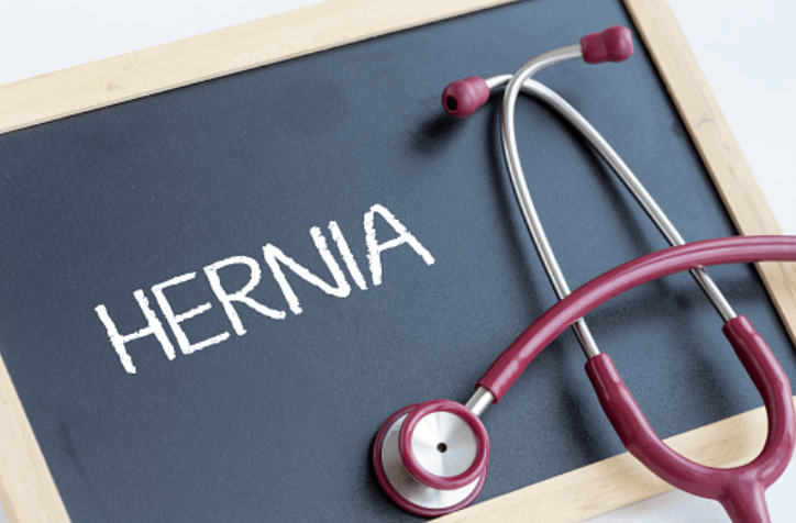 hernia disease